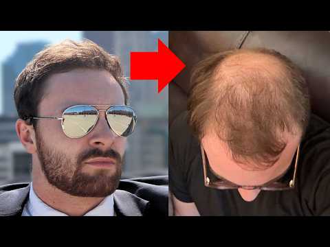 BALDING DESTROYED MY CONFIDENCE - Here's How I Got It Back