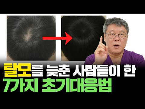 탈모약 아무리 먹어도 이것 안 바꾸면 소용 없습니다 ㅣ 탈모 발견시 해야할 초기 대응 행동양식