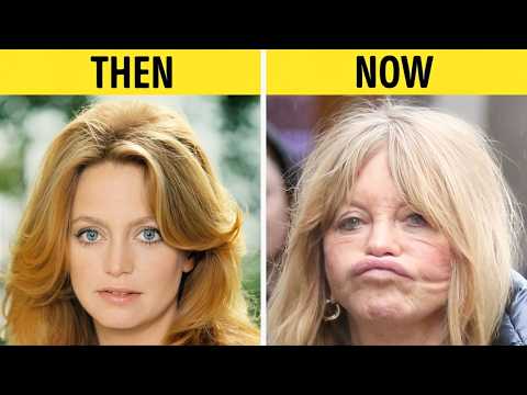 50+ Celebrities Who Aged Badly | Then and Now
