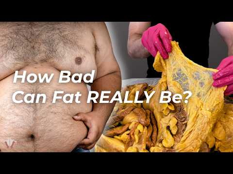 How Too Much Fat Affects Nearly Every Part of Your Body