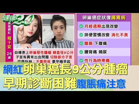 千萬網紅25歲卵巢癌長9公分腫瘤 警世不要熬夜 健康2.0