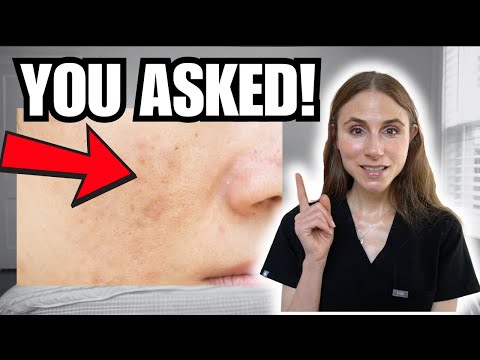 Dermatologist Answers Your MOST Googled Skincare Questions (Dark Spots, Pores, Barrier Repair)