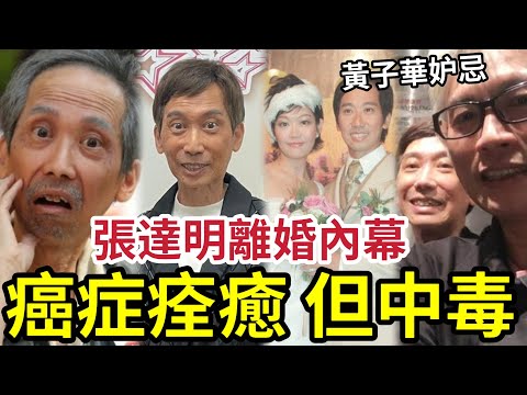 張達明中毒！被指最後時光？癌症痊癒竟「再度病危」竟是醫療後遺症！與老婆離婚真相！黃子華一生最妒忌的人！