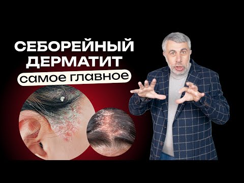 Seborrheic dermatitis: The most important thing