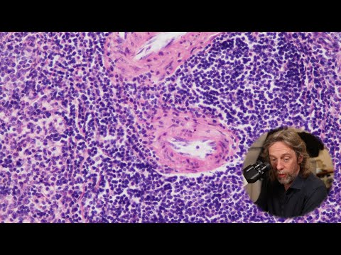 Histology of the spleen