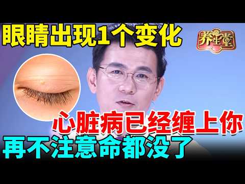 眼睛出现1个变化 心脏病已经缠上你,再不注意命都没了【我是大医生】