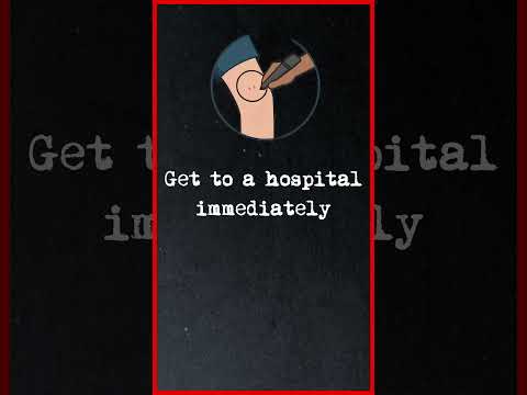 Surviving a Venomous Snake Bite 🐍