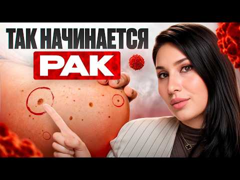 How not to miss STAGE 1 CANCER: symptoms that EVERYONE IGNORES!