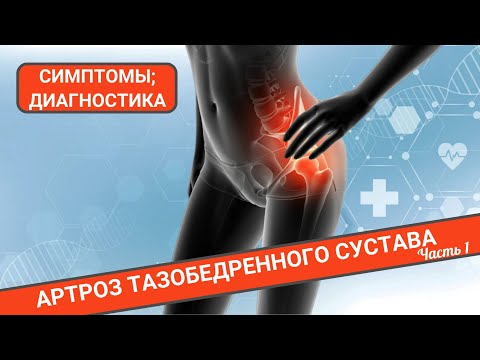 АРТРОЗ ТАЗОБЕДРЕННОГО СУСТАВА. СИМПТОМЫ И ДИАГНОСТИКА. (Часть 1)