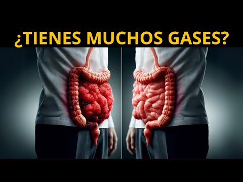 ¿POR QUÉ SE NOS HINCHA LA PANZA? - PRINCIPALES CAUSAS Y TRATAMIENTO