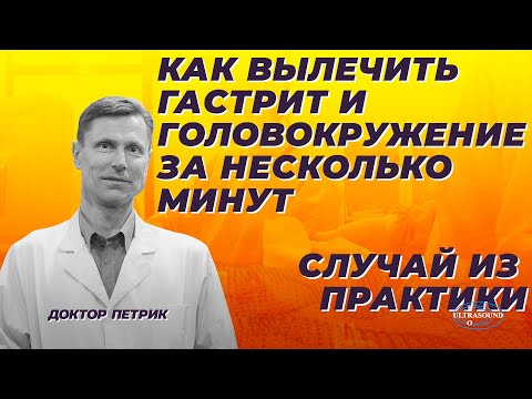 Как вылечить гастрит и головокружение за несколько минут. Пример из практики