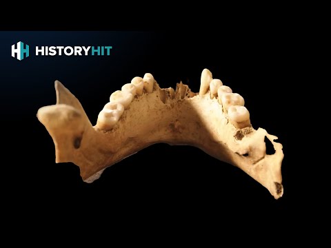 This Medieval Skull's Axe Wounds Reveal BRUTAL Anglo-Saxon Battle