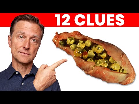 The 12 Signs that Your Gallbladder is in DANGER