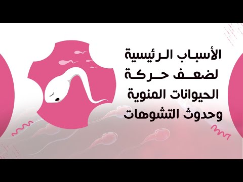 3 أسباب لحدوث تشوهات الحيوانات المنوية وضعف الخصوبة تجنبها مع د محمد عباس #طبيبك اليوم
