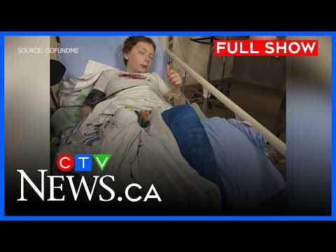 Child hurt in hit-and-run endures painful recovery | CTV News Calgary at 11:30 for March 12, 2026