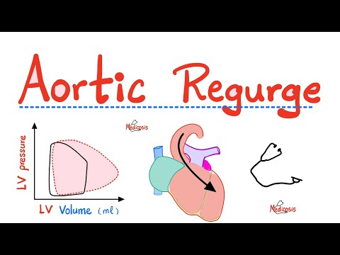 Aortic Regurgitation (AR) - Aortic Insufficiency - Valvular Heart Disease (VHD) - Cardiology