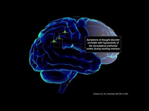 Prefrontal Cortical Circuits in Schizophrenia Molecular Vulnerabilities & Treatments