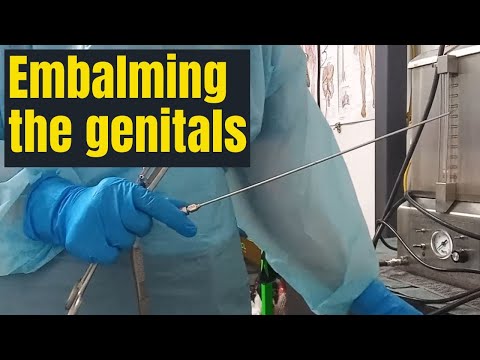 Ensuring the genitals are fully embalmed