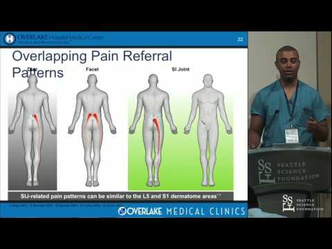 SI Joint Fusion - Abhineet Chowdhary, MD