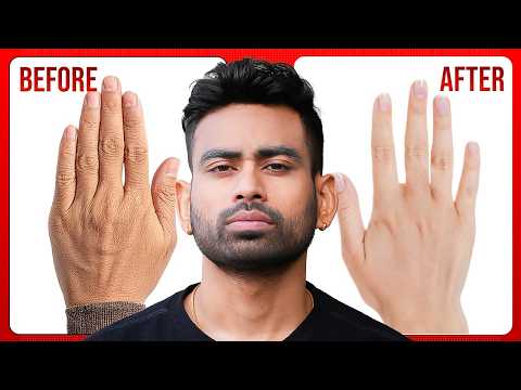 त्वचा का रूखापन - Dry Skin Permanent Solution | Fit Tuber Hindi