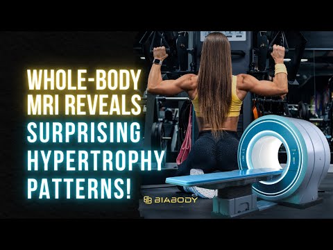 Whole-Body MRI Study Reveals Surprising Hypertrophy Patterns!