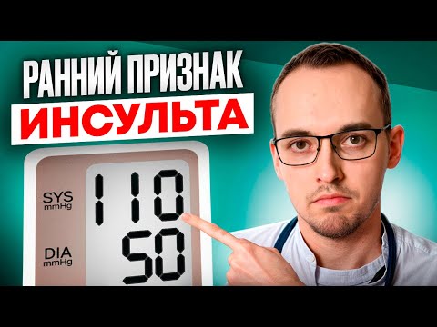 ТОП-3 ОПАСНЫХ ПРЕДВЕСТНИКА ИНСУЛЬТА. Как спасти сосуды головного мозга?