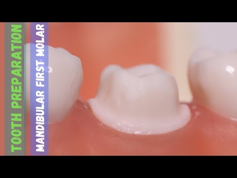 Mandibular First Molar 🔵 Tooth Preparation for PFM 🟡 Step by Step Demonstration