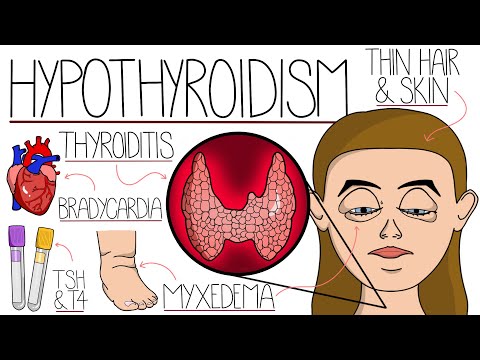 Hypothyroidism Explained Clearly