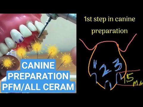 Dr VK's Dental Skool | MAXILLARY CANINE PREPARATION |ALL CERAMIC | METAL CERAMIC (PFM) CROWN