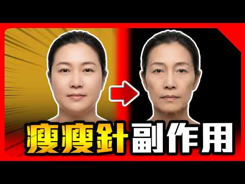 瘦下來更顯老態! 猛健樂、週纖達的隱藏代價...