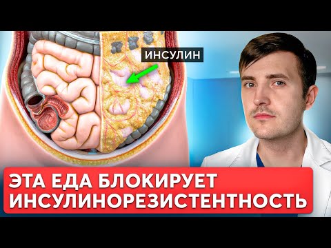 Как худеть при инсулинорезистентности? Продукты, которые ее остановят!