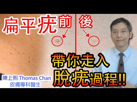 Dermatologist |Dr Chan Sheung Hey Thomas