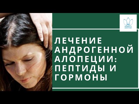 ЛЕЧЕНИЕ АНДРОГЕНЕТИЧЕСКОЙ АЛОПЕЦИИ У ЖЕНЩИН Пептиды Андрогенная алопеция Интегративная медицина