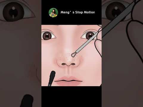 Satisfying Full Blackhead Treatment At Home! ASMR skincare animation | Meng's Stop Motion