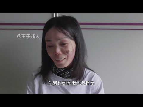 我是史铁生，我身边的人都是余华 #蝴蝶宝贝 #罕见病 #纪录片 #女孩子 #姐姐 @邹碧莹（蝴蝶宝贝）