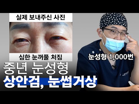 중년 눈성형 - 직접 보내주신 사진을 봤을 때 저의 생각은요 /상안검,눈썹 거상, 눈꺼풀 처짐