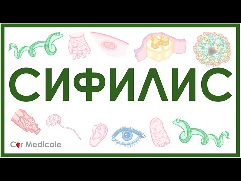 Сифилис - этиология, стадии, причины, симптомы, диагностика, лечение