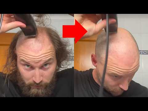 This ONE video is all you need to fully embrace your balding