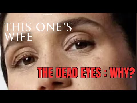 The Dead Eyes : Why?  (Meghan Markle)