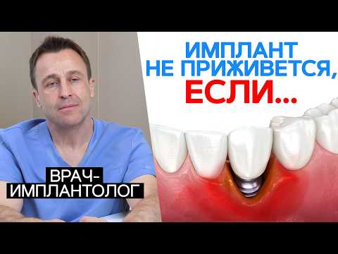 ОСЛОЖНЕНИЯ после имплантации, о которых молчат врачи! / Как исправить периимплантит?