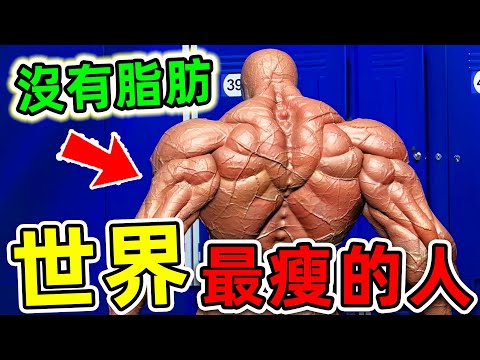 全世界最瘦的10個人！第一名體重不到60斤，一天卻要吃80頓飯，否则就有生命危险。|#世界之最top #世界之最 #出類拔萃 #腦洞大開 #top10 #最瘦的人