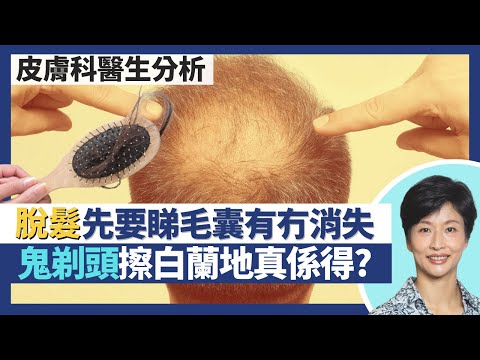 脫髮｜頭髮稀疏要觀察毛囊有否消失 掉髮治療方案各有不同！斑禿鬼剃頭擦白蘭地生薑真的可行？頭癬個案增因寵物 頭髮再生醫人亦要醫寵物？｜王建芳醫生 皮膚科何景文醫生｜人類健康研究所