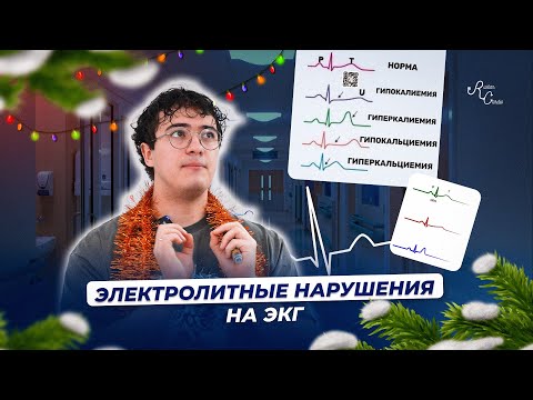 Электролитные нарушения на ЭКГ