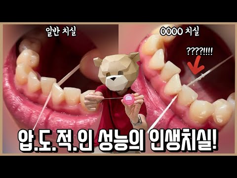 이 영상 끝까지보면 적어도 이빨 두개는 살린다! 인생치실 간증리뷰ㅣ내돈내산