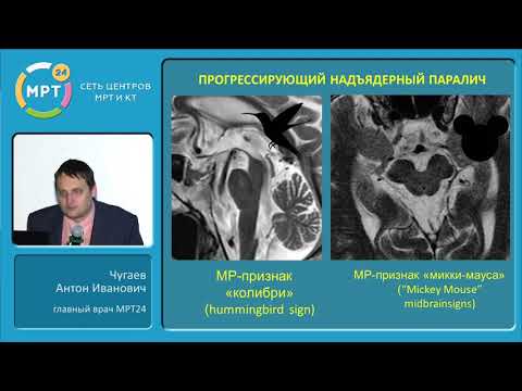 МР-диагностика нейродегенеративных заболеваний