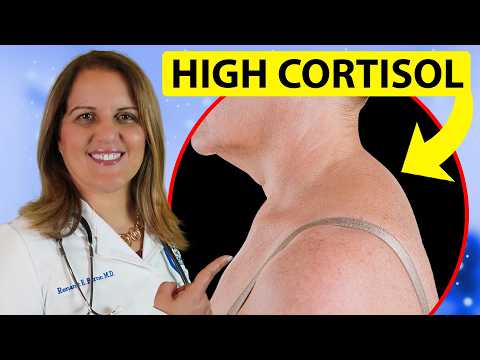 12 Signs of HIGH CORTISOL You Can See – Doctor Explains
