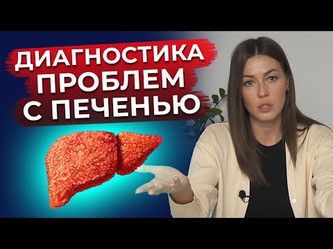 Как понять, что твоя печень больна? / Признаки болезни печени!