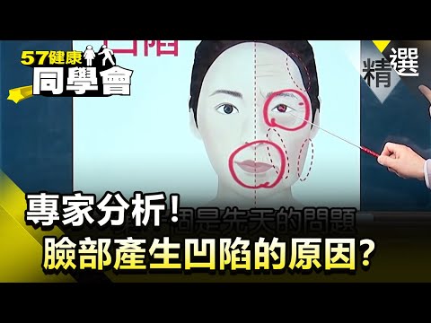 專家分析!臉部產生凹陷的原因?【健康同學會】精華篇|隋安德 許晶晶