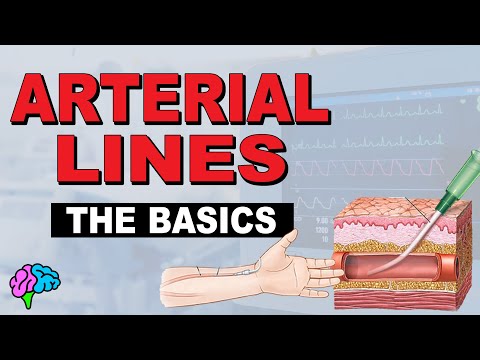 What is an A-line? Arterial Line Basics EXPLAINED!