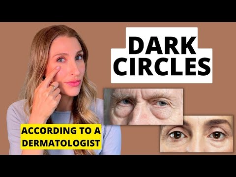 Can You Get Rid of Dark Circles Under Your Eyes? Dermatologist Explains | Dr. Sam Ellis